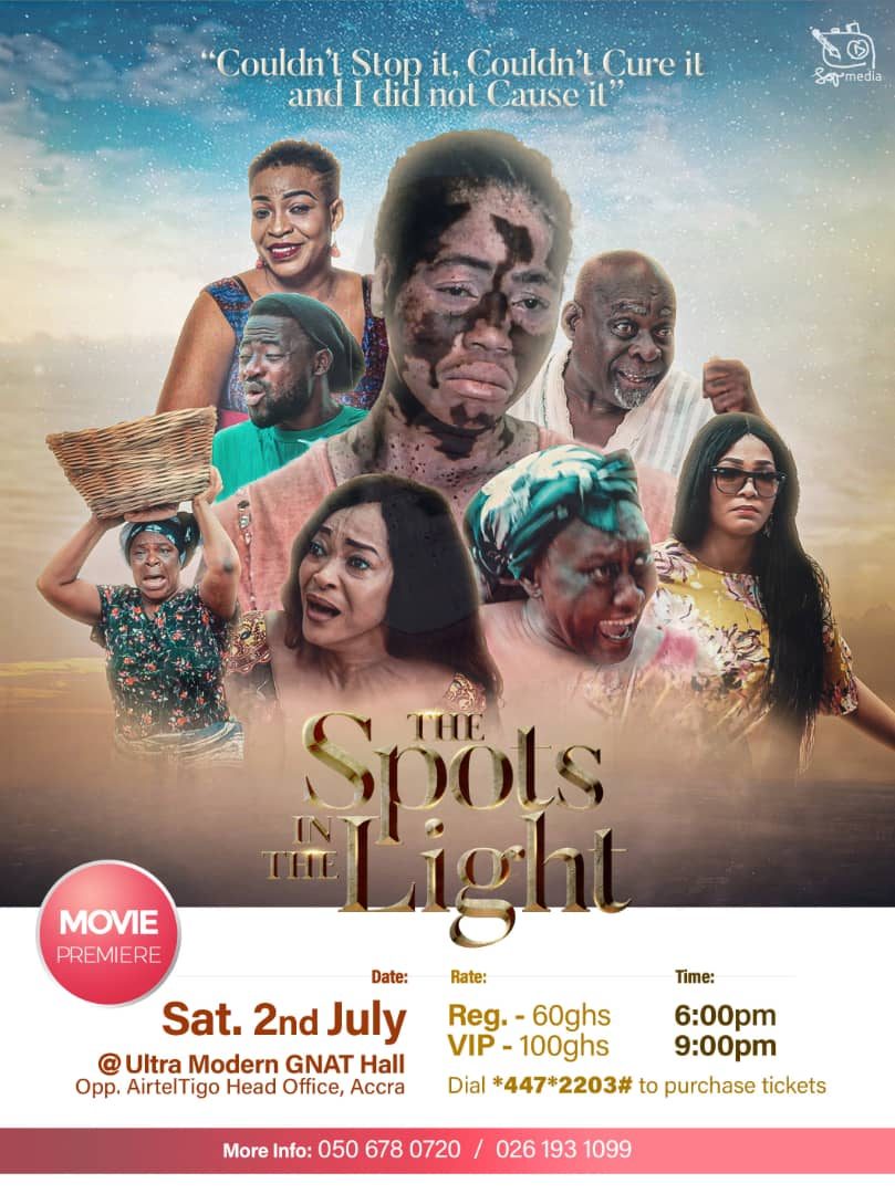 The Spots In The Light (A Vitiligo/Albino skin condition) Movie Premiere