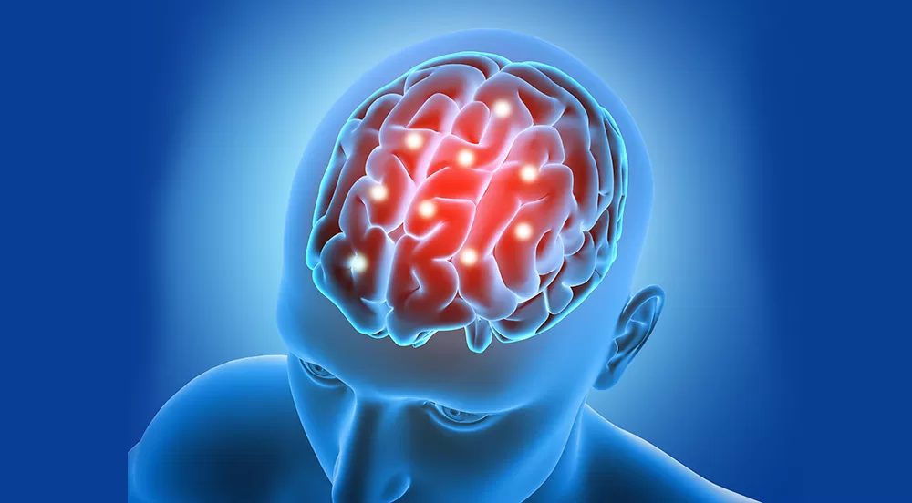 Nearly half of Ghana's stroke cases now hit men aged 30 to 49, health expert warns
