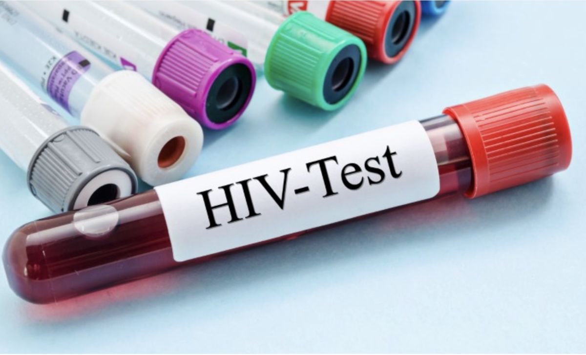 GAC Urges End to Discrimination Against HIV Patients in Jobs and School Admission